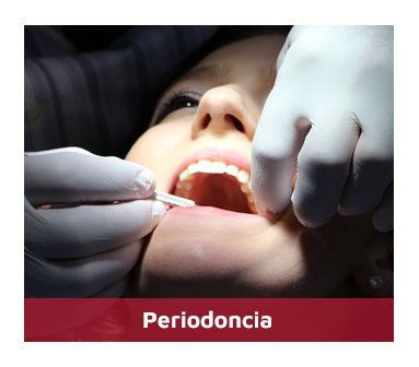 Periodoncia-1